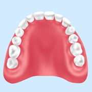 レジン義歯